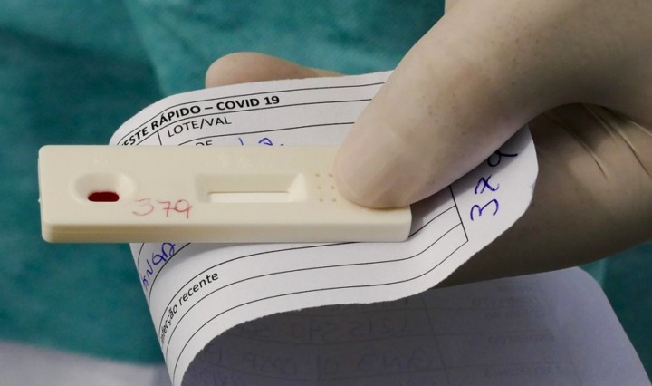 Brasil-registra-o-menor-numero-de-casos-de-COVID