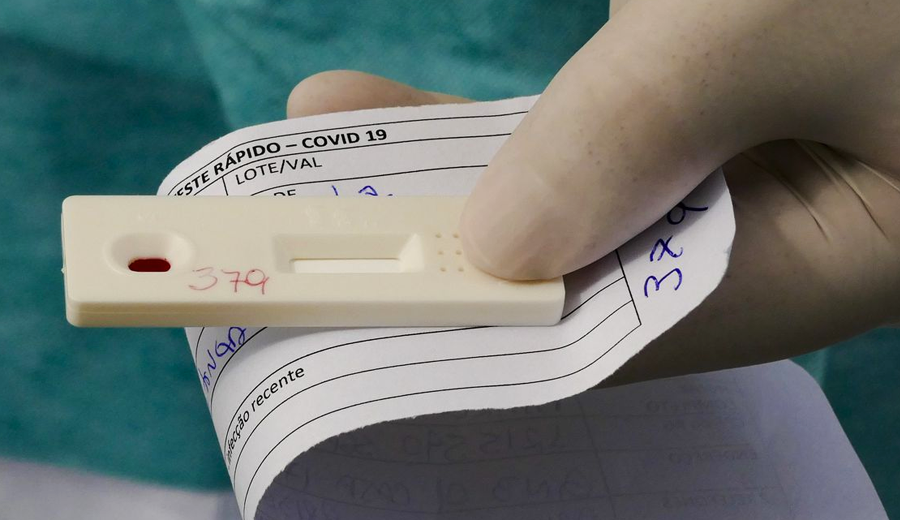 Brasil-registra-o-menor-numero-de-casos-de-COVID